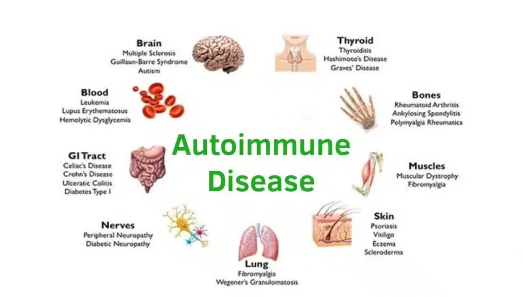Biology Lesson on Autoimmune Diseases .jpg