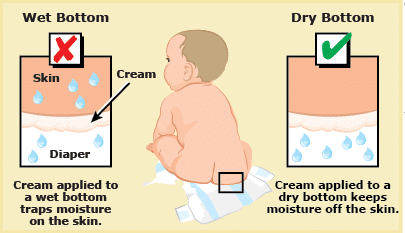 How to Effectively Prevent Diaper Rash?