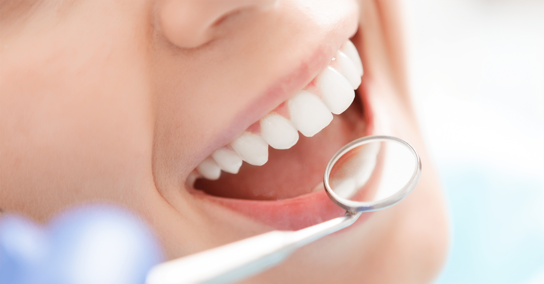Preventive Measures for Better Oral Health