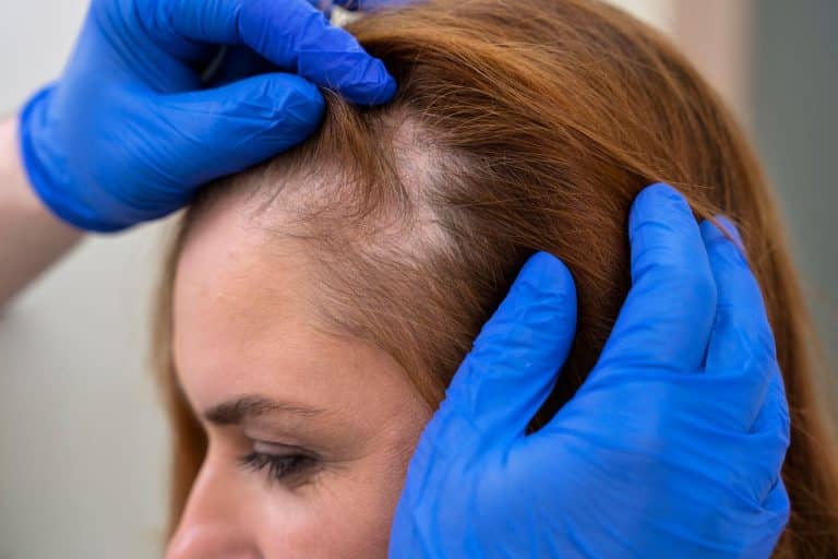The Indian Hair Care Brands Redefining Hair Loss Treatment The Indian Hair Care Brands Redefining Hair Loss Treatment